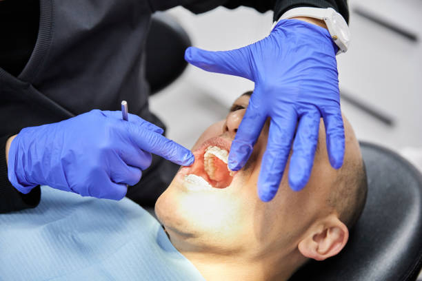 Best Emergency Tooth Extraction in Factoryville, PA